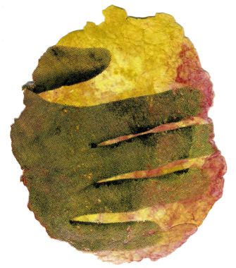 I. S. 62 Unfassbare Hand